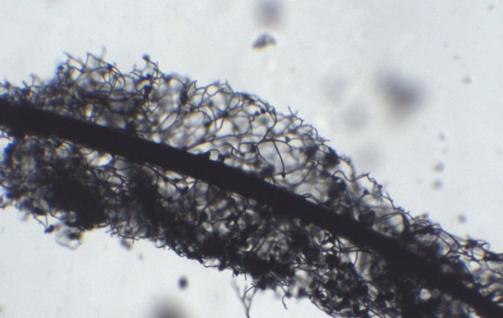 Stemonitis? Stemonitopsis?